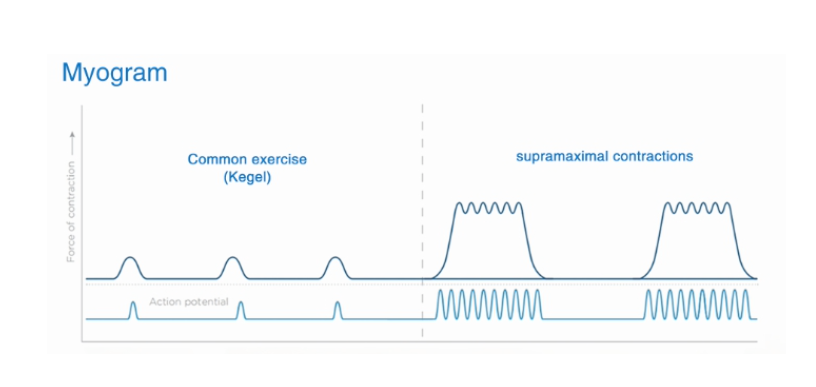 Pelvic Floor Strengthening (6 Month Maintenance)